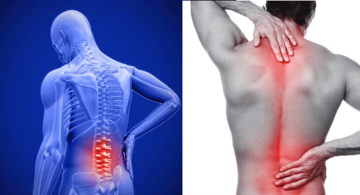 home remedy for back pain