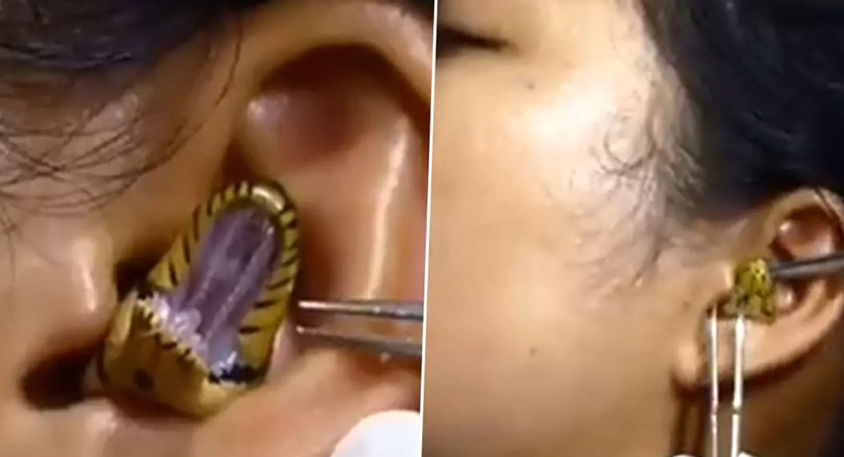 snake gets into ear of a woman video viral